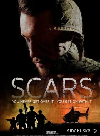 постер к смотреть бесплатно Шрамы / Scars 2024